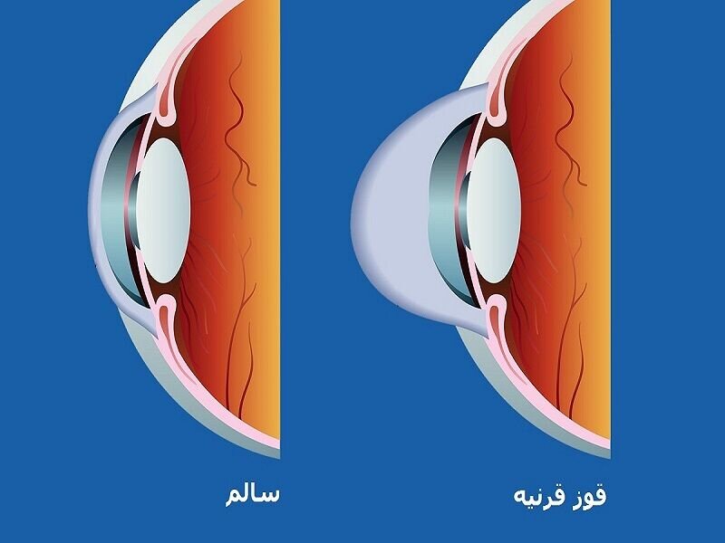 از افتتاح بزرگترین ایستگاه شارژ الکتریکی کشور تا تشخیص زودهنگام قرنیه.