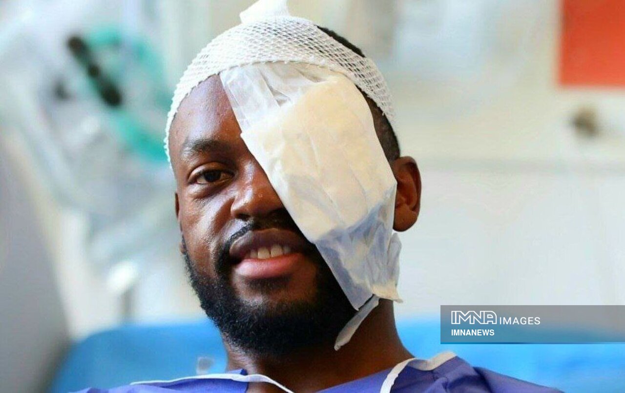 بیوگرافی کوین یومگا از استقلال تا نساجی + عکس همسر ، سن و داستان آسیب دیدگی چشم