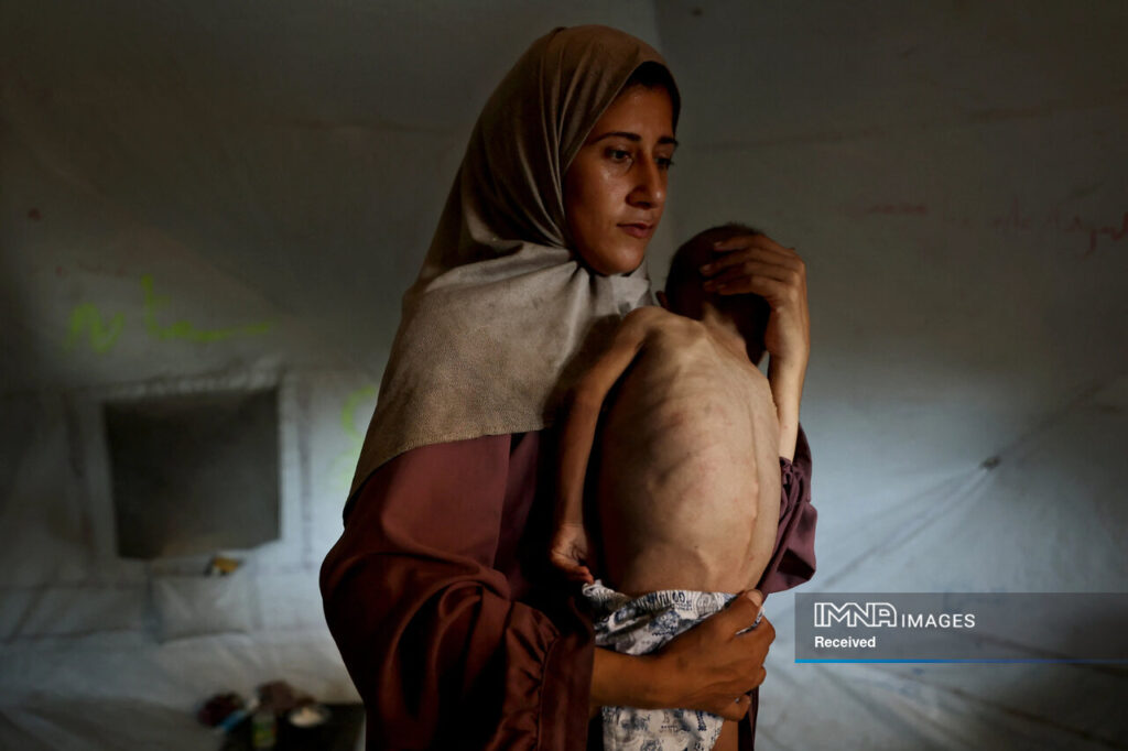 آمار شهدای گرسنگی در غزه به ۲۱۷ نفر رسید/ ۱۰۰ کودک به شهادت رسیدند