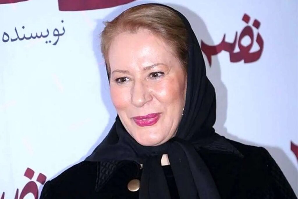 وضعیت جسمی خانم بازیگر پایدار نیست