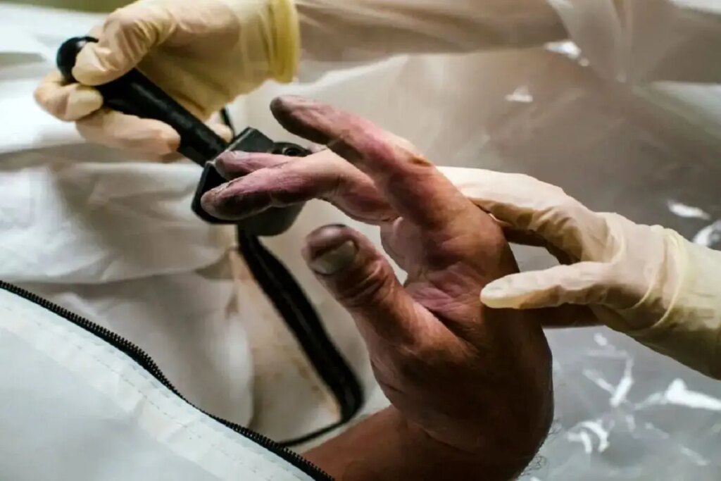 نرخ دیه در سال 1404؛ فرق زن و مرد چقدر است؟