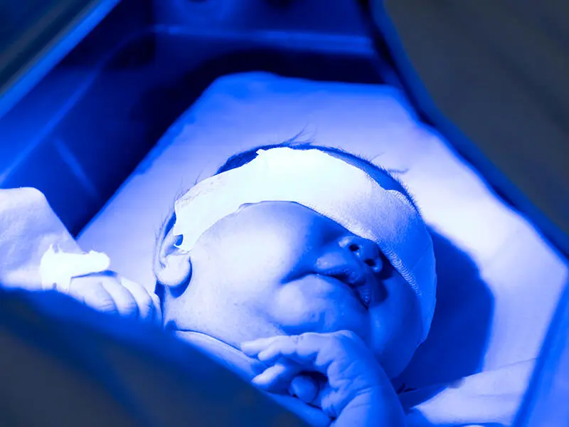 پایش زردی نوزاد با حسگر بزاقی هوشمند، بدون درد و خون‌گیری