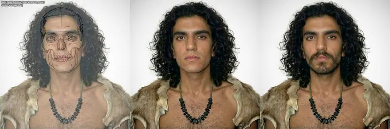 بازسازی صورت