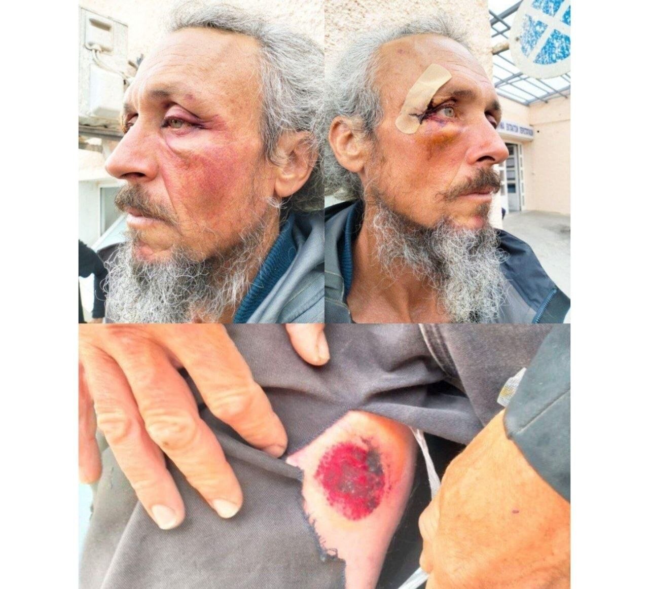 جزئیات وحشتناک شکنجه 40 ساعته فعالان کاروان صمود + تصاویر جزئیات وحشتناک شکنجه 40 ساعته فعالان کاروان صمود + تصاویر