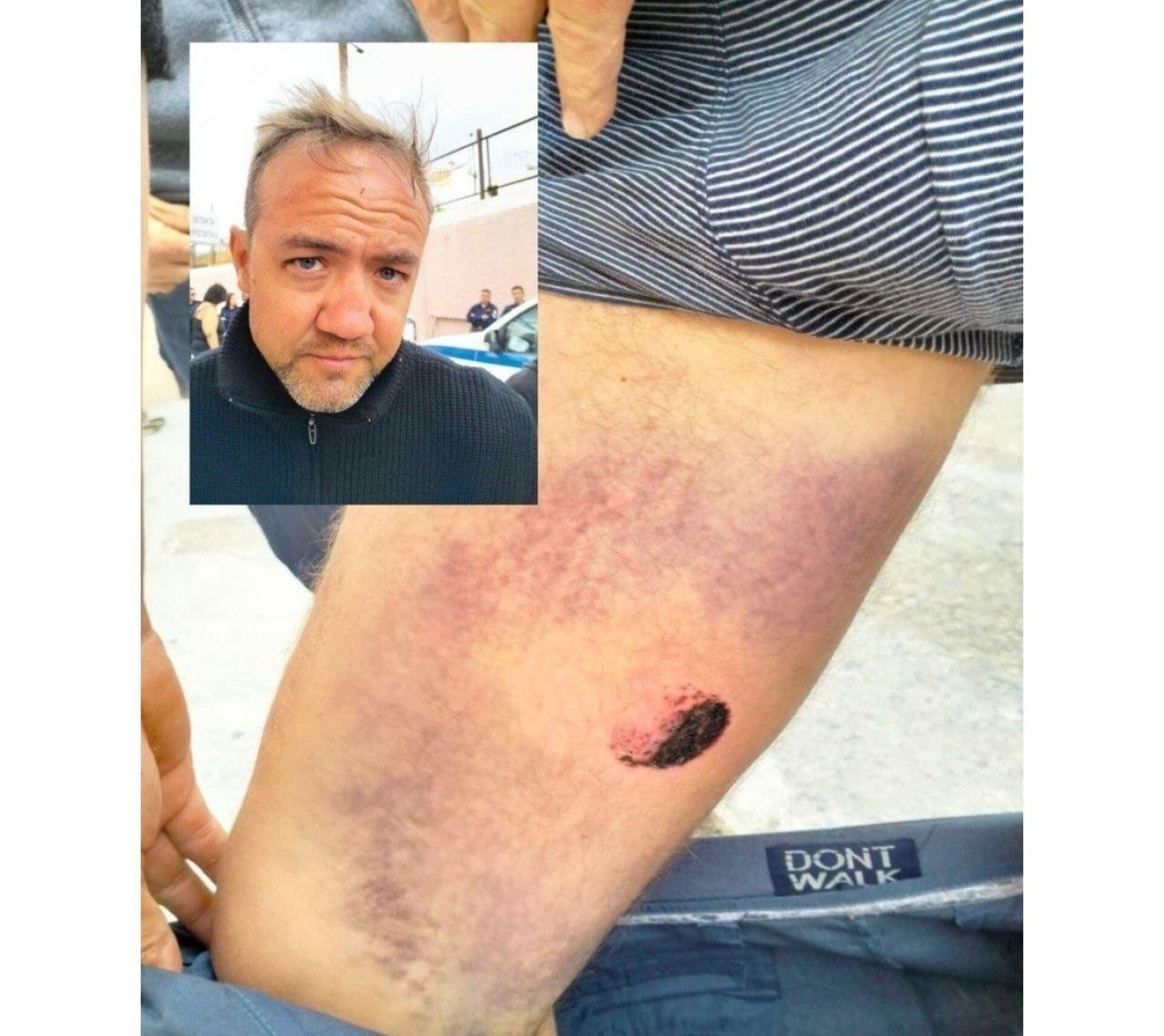 جزئیات وحشتناک شکنجه 40 ساعته فعالان کاروان صمود + تصاویر جزئیات وحشتناک شکنجه 40 ساعته فعالان کاروان صمود + تصاویر